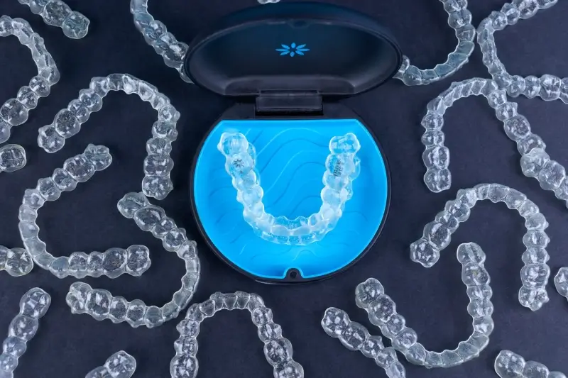 Jak długo trwa leczenie nakładkami Invisalign?