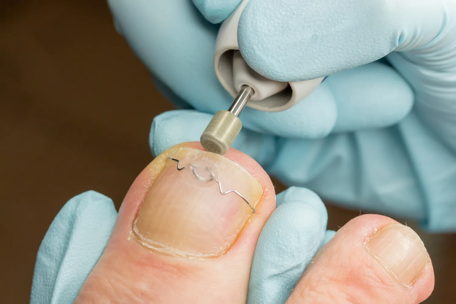 Co to jest ortopodologia?