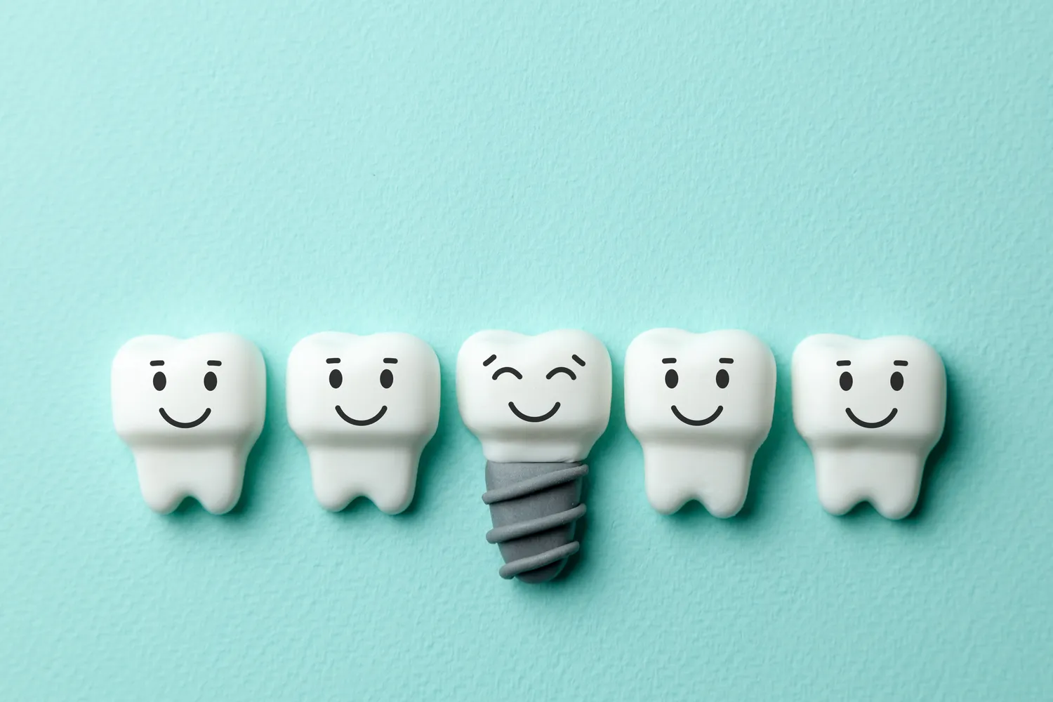 Implanty zębów cała szczęka Lublin