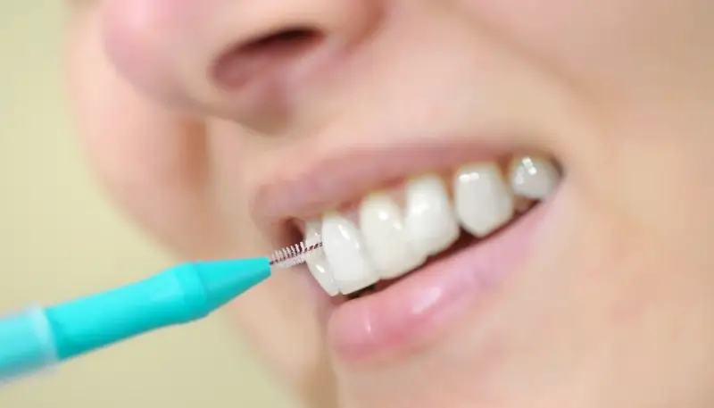 Co to jest leczenie kanałowe?