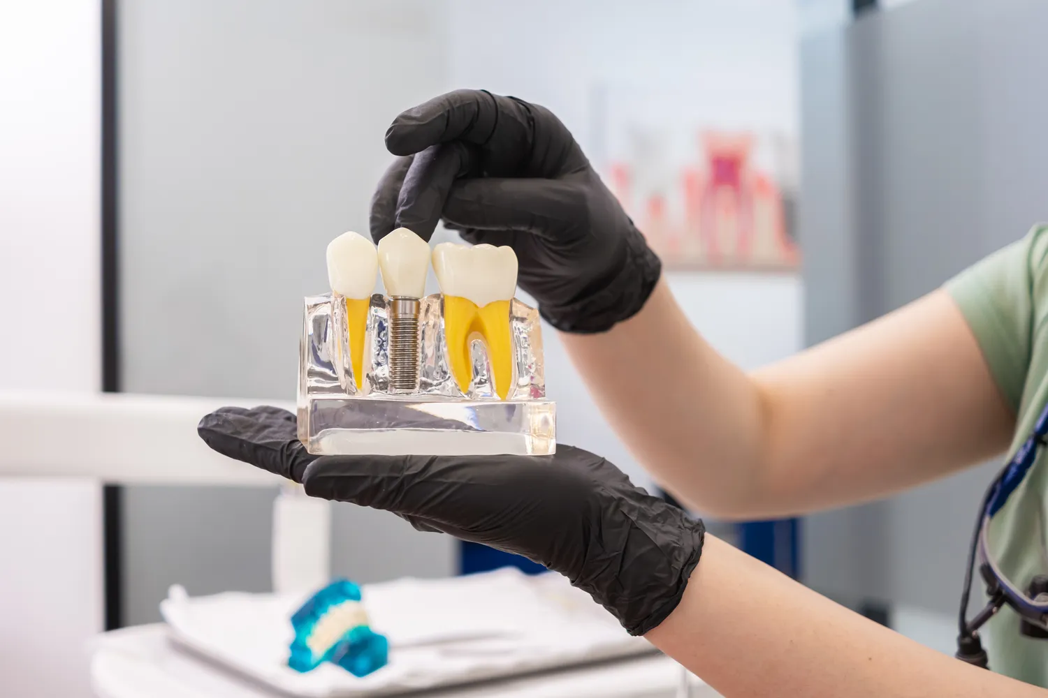 Implanty zębów cała szczęka cena Szczecin