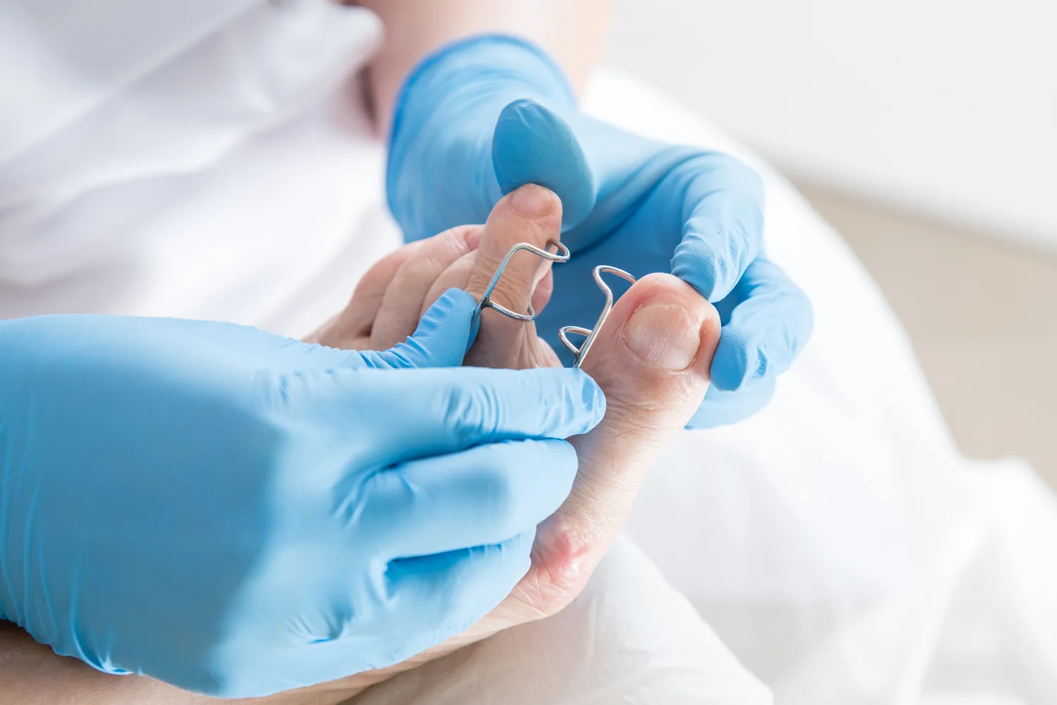 Podologia - pomoc dla stóp